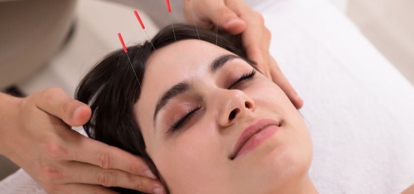 maux de tête et acupuncture