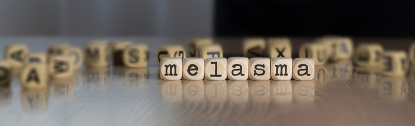 mélasma