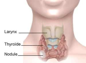 schéma indiquant où se trouve la thyroïde