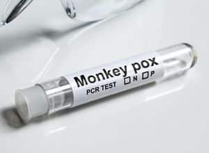 test pcr pour identifier le virus de la variole du singe