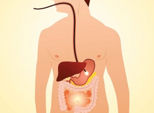 endoscopie digestive