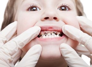 Jeune fille avec les dents abimées