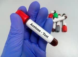 test sanguin pour trouver une Acidocétose diabétique