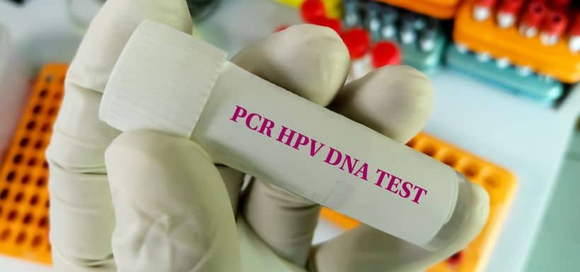 Analyse HPV