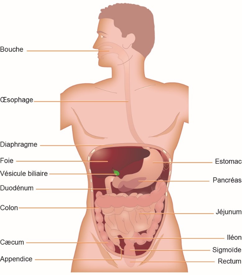 occlusion intestinale