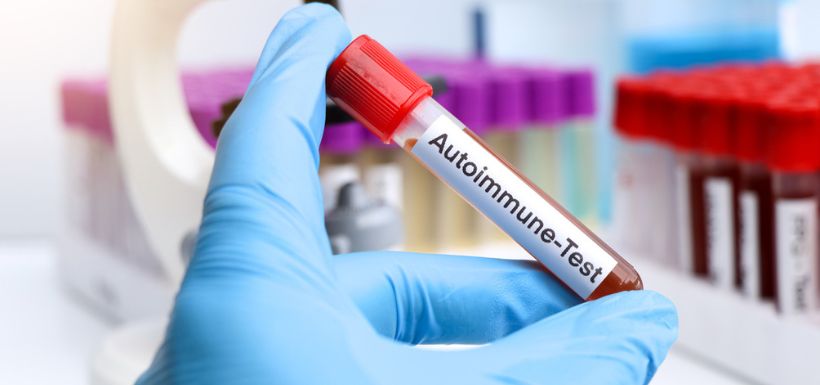 autoimmunité