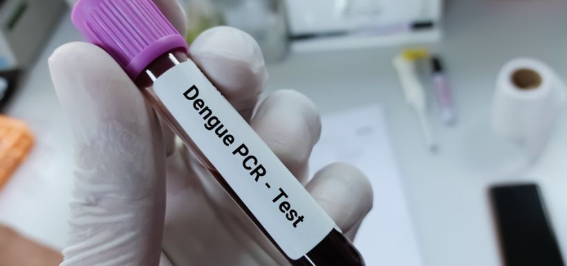 teste Dengue PCR